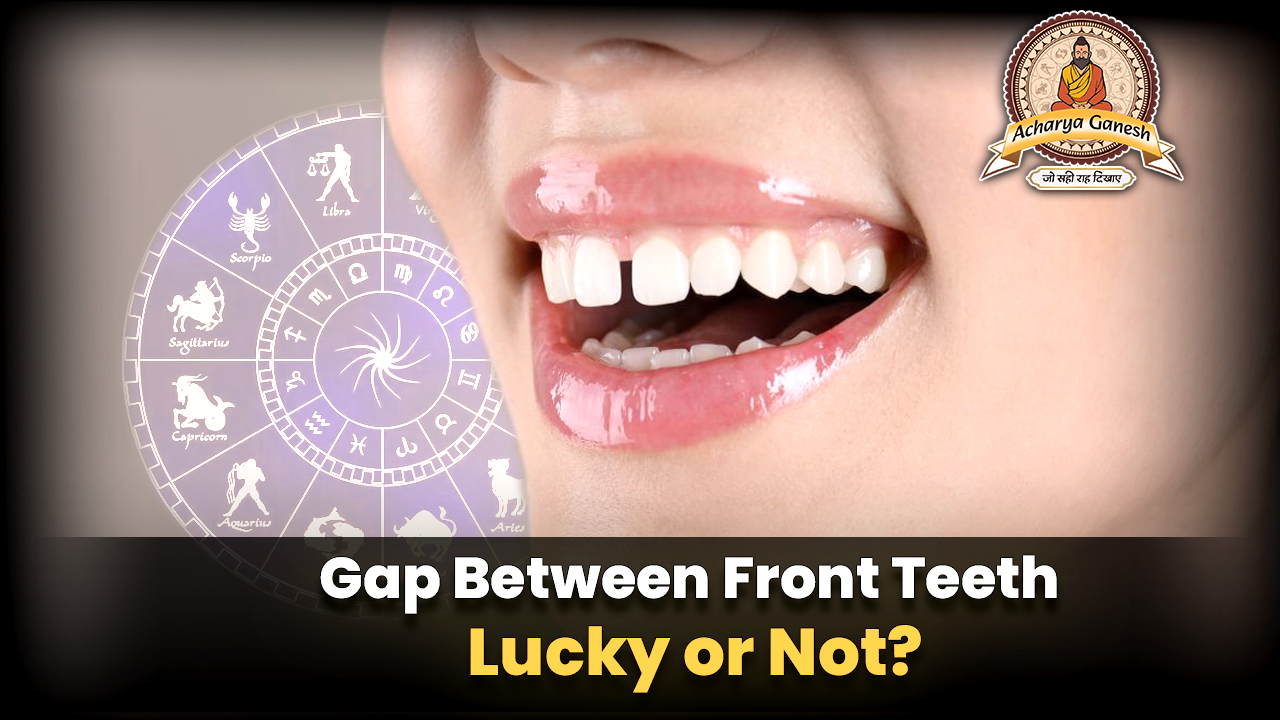 Gap Between Front Teeth